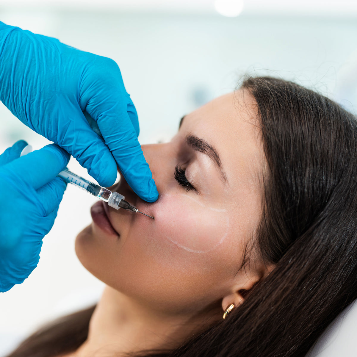 Hyaluronic acid being administered in a clinical setting