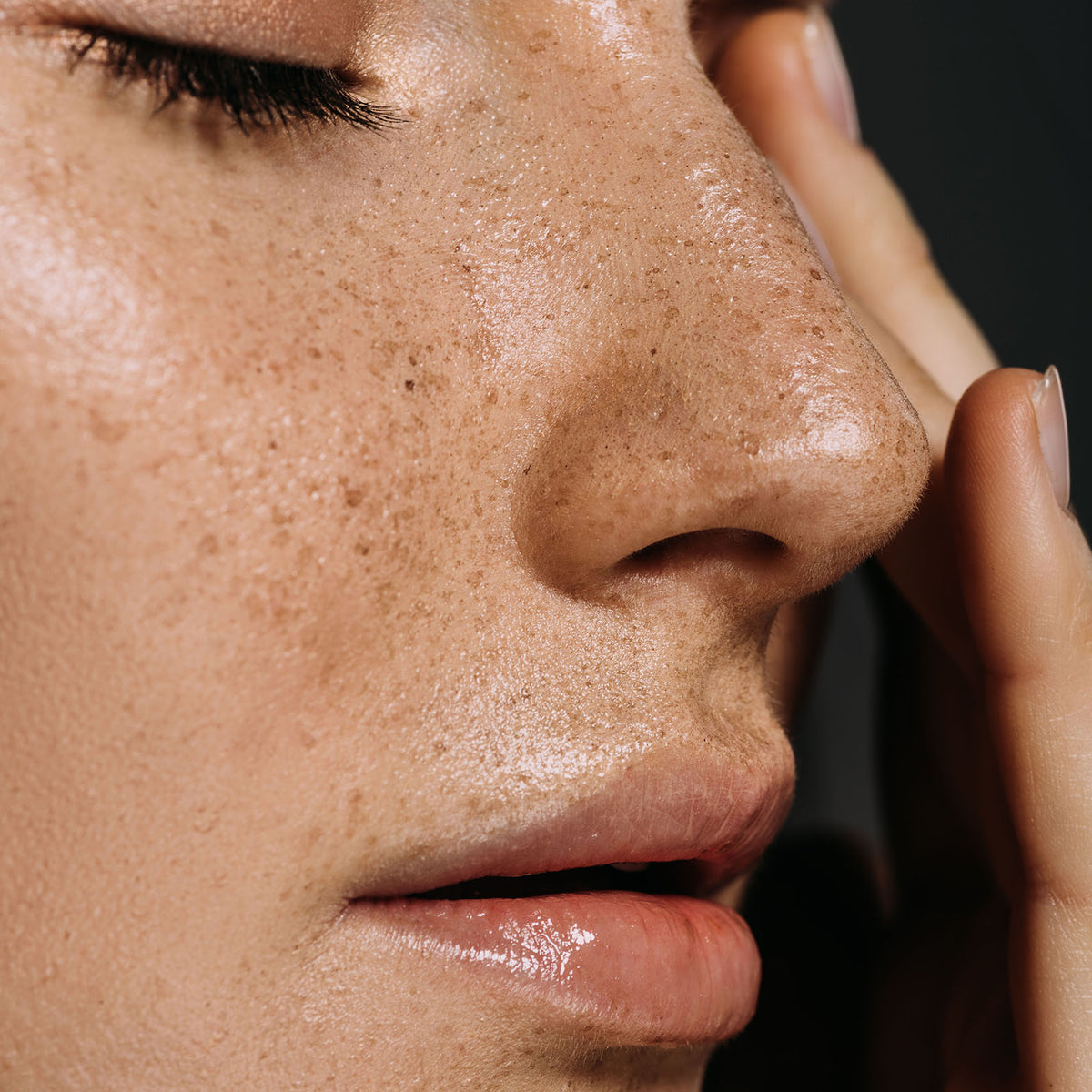 Close-up of freckled skin, eyes closed, fingertip resting at the temple