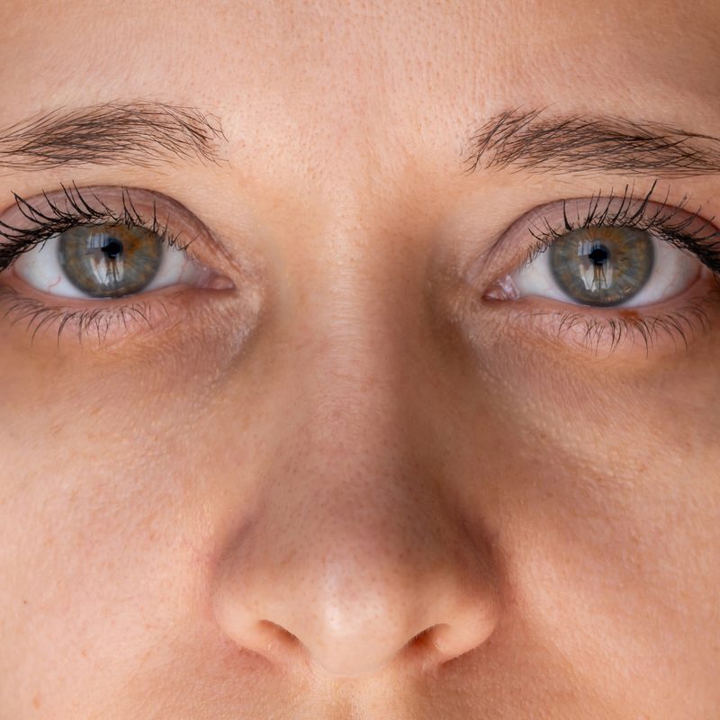 Close-up of a woman's eyes and under-eye area, direct gaze, natural light