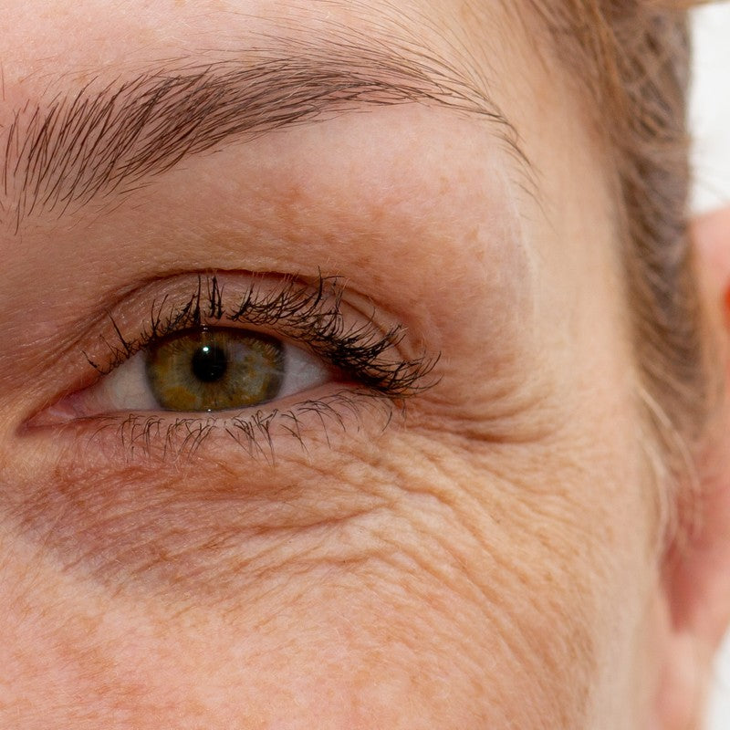 Close-up of a woman's eye showing fine lines and crepey under-eye skin in natural light